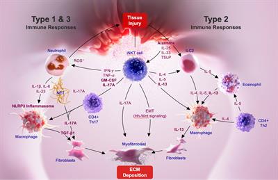 Type 1 invariant natural killer T cells in chronic inflammation and tissue fibrosis